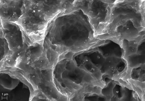 Abbildung: Oberfläche Titanimplantat 20000x Vergrößerung